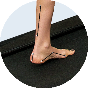 Analyse posturale : examen du pied