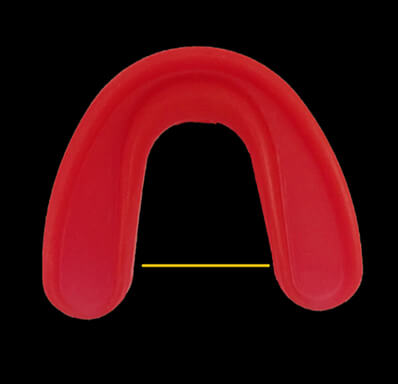 Ecart branches latérales