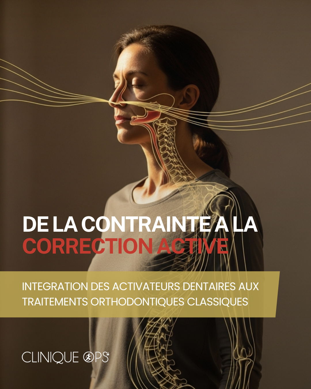 DE LA CONTRAINTE A LA CORRECTION ACTIVE : INTEGRATION DES ACTIVATEURS DENTAIRES AUX TRAITEMENTS ORTHODONTIQUES CLASSIQUES