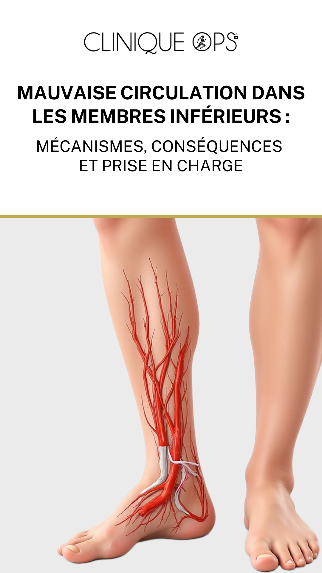 MAUVAISE CIRCULATION DANS LES MEMBRES INF&Eacute;RIEURS : M&Eacute;CANISMES, CONS&Eacute;QUENCES ET PRISE EN CHARGE
